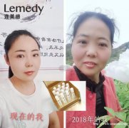 连美缔携手时光大师，引领冻龄潮流 .